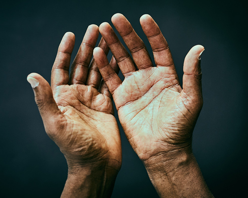 The palms of two hands.