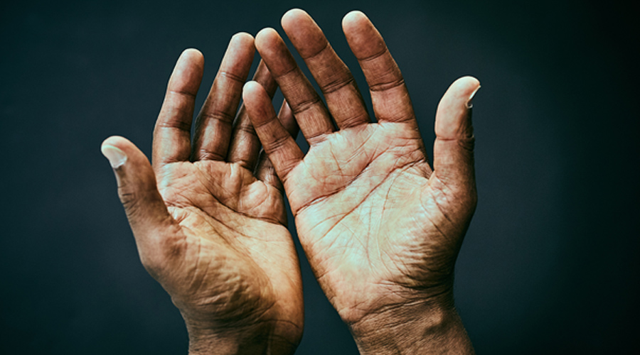 The palms of two hands.
